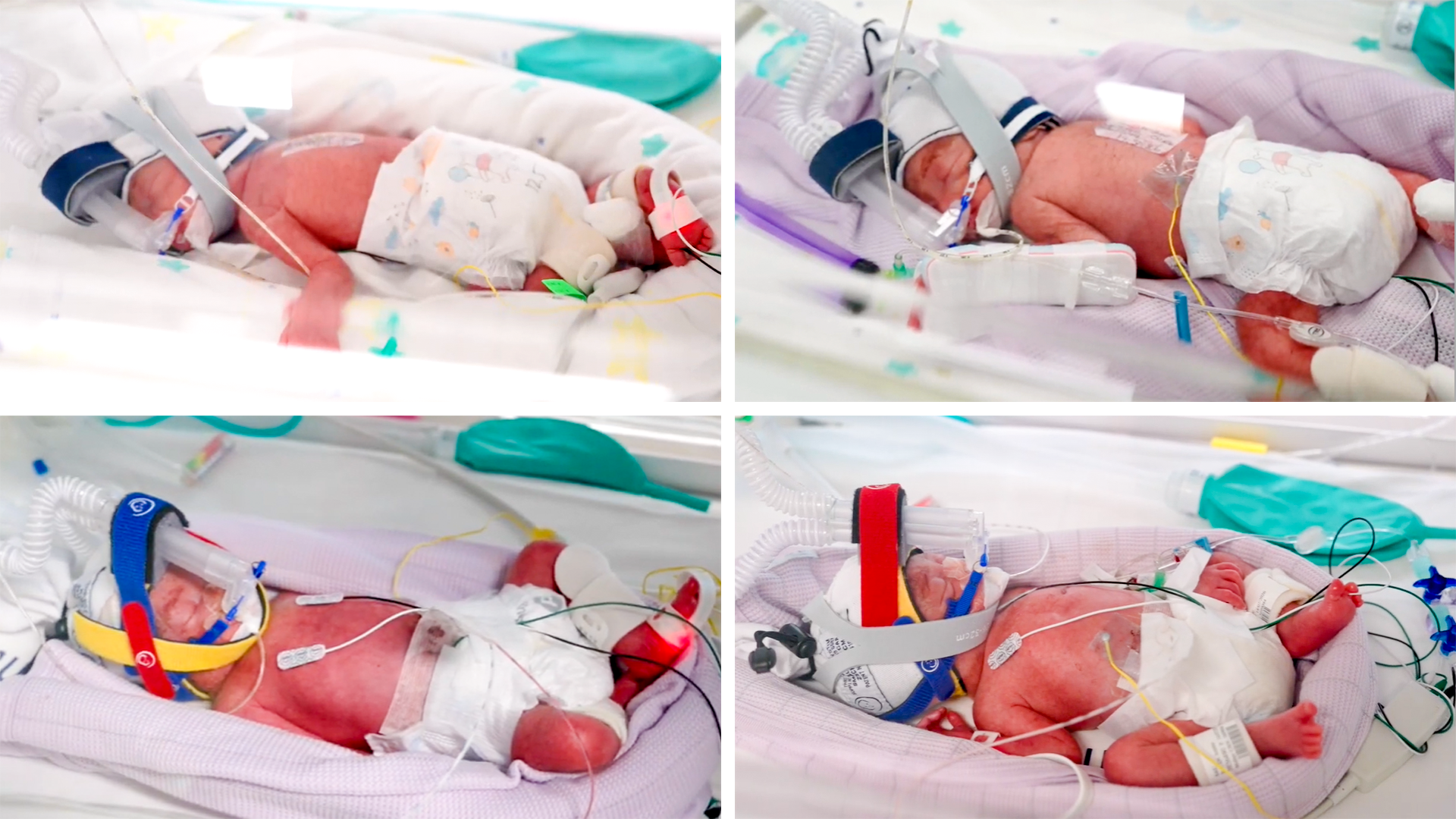Australia Welcomes Rare Identical Quadruplets: A Miracle Birth