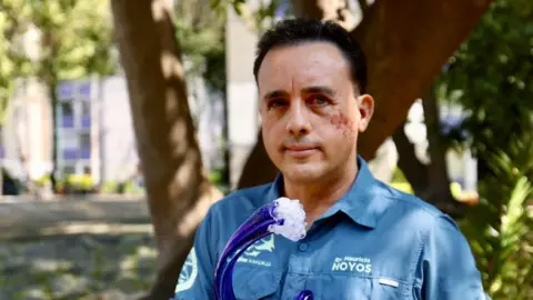 'This animal spared my life': Shark-Bitten Biologist Reflects on His Encounter