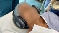 A new study from Delhi reveals that playing music during surgery may enhance recovery and reduce the need for anaesthetics. The implications for surgical practices could be significant as researchers delve deeper into the connection between auditory stimuli and patient outcomes.
