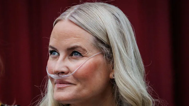 Norway’s Crown Princess Undergoes Successful Lung Transplant, Palace Says