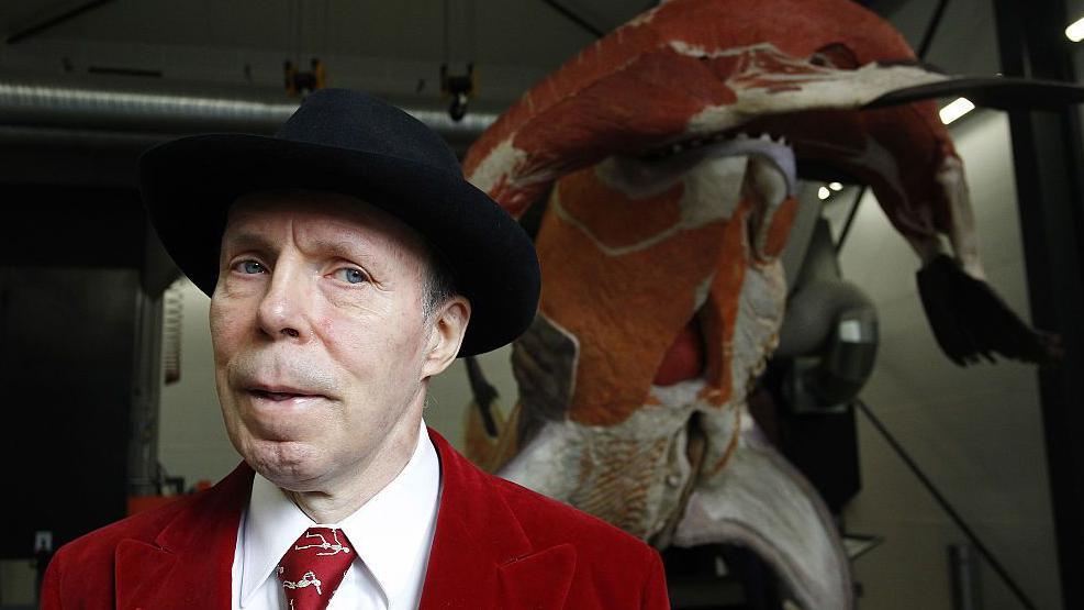Gunther von Hagens, the 'Body Worlds' pioneer, dies at 81